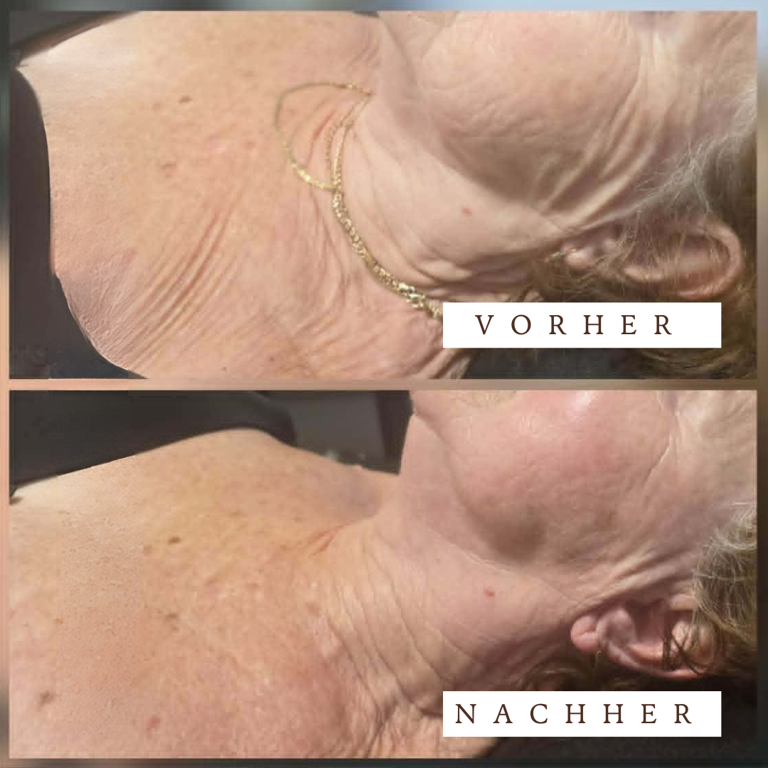 Eine Frau erhält in einem Spa-Setting eine Gesichtsbehandlung von einer anderen Frau. Energetisches Facelifting in Wangen im Allgäu: eine sanfte, nicht-invasive Gesichtsbehandlung mit intuitiver Energiearbeit für sichtbare Frische, Entspannung und natürliche Ausstrahlung.